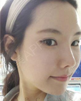 娱乐吃瓜酱不用做鼻子,揭秘明星隐私，不做鼻子也能畅游娱乐圈